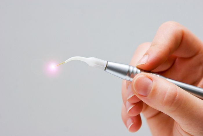Dental-Laser zur Laserbehandlung.